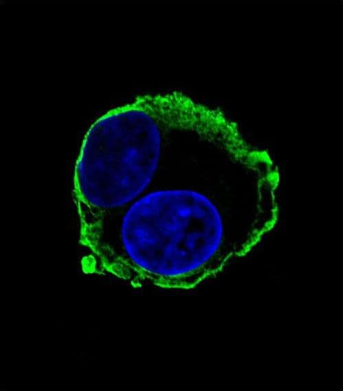 Monoclonal Mouse anti-Human MMP14 Antibody (aa470-499, IF, WB)