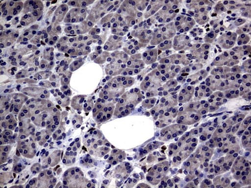 Monoclonal Mouse anti-Human PRX-1 / PRRX1 Antibody (clone OTI6A4, IHC, WB)