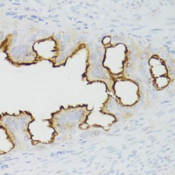 Polyclonal Rabbit anti-Human CTNNB1 / Beta Catenin Antibody (IHC, WB)