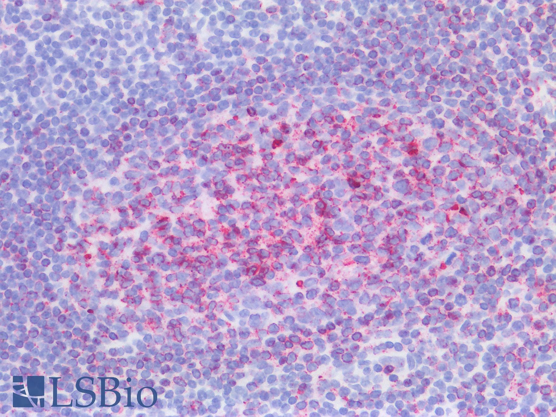 IHC-plus™ Monoclonal Mouse anti-Human CD74 / CLIP Antibody (clone CDLA74-1, Azide-free,BSA-free, IHC, IF)