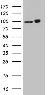 KPNB1 / Importin Beta Antibody (aa1-200, clone OTI9D6)