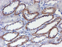 ERBB2 / HER2 Antibody (aa676-1255, clone OTI11A7, Carrier-free)