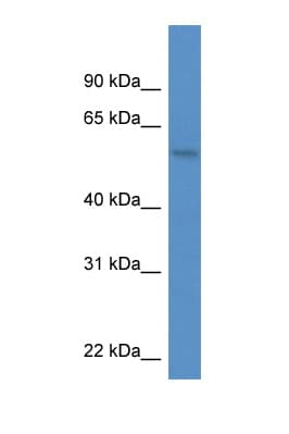 Polyclonal Rabbit anti-Human MON1A / SAND1 Antibody (aa376-425, WB)