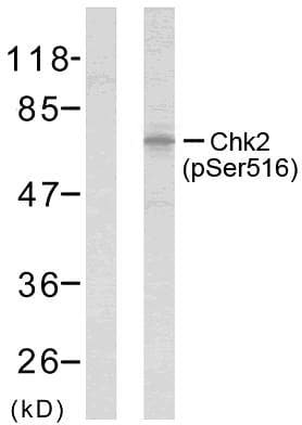 Polyclonal Rabbit anti-Human CHEK2 / CHK2 Antibody (phospho-Ser516, WB)