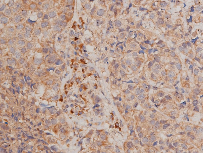 CHUK / IKKA / IKK Alpha Antibody (phospho-Ser176,pSer177)
