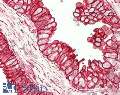 Polyclonal Rabbit anti-Human SLC26A1 Antibody (C-Terminus, IHC, WB)