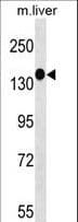 IHC-plus™ PEAK1 / SGK269 Antibody (aa673-699)