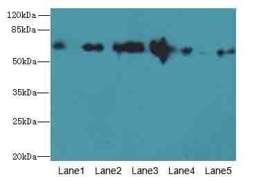 PLK1 / PLK-1 Antibody