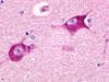 IHC-plus™ Polyclonal Rabbit anti-Human HRH3 / Histamine 3 Receptor Antibody (Cytoplasmic Domain, IHC, WB)