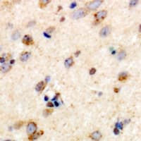 Polyclonal Rabbit anti-Human TRIM59 Antibody (IHC, IF, WB)