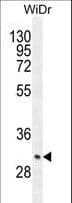ZC4H2 Antibody (aa196-224)