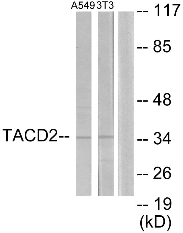 IHC-plus™ TROP2 / TACSTD2 Antibody (aa131-180)