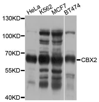Polyclonal Rabbit anti-Human CBX2 Antibody (WB)