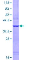 Human MYO5A / Myosin V Protein (Recombinant GST, N-terminus)