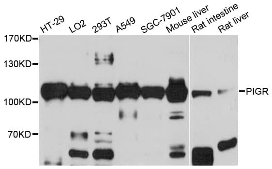 PIGR Antibody (aa20-270)
