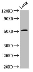 ARHGAP1 / CDC42GAP Antibody