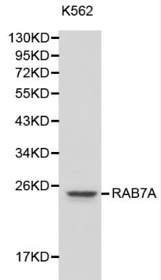 Polyclonal Rabbit anti-Human RAB7A / RAB7 Antibody (IHC, WB)