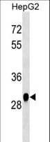 HMT / HNMT Antibody