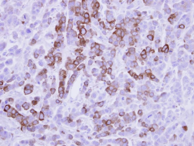 MX1 / MX Antibody (aa194-475)