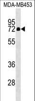 Polyclonal Rabbit anti-Human ZNF57 Antibody (aa74-101, WB)