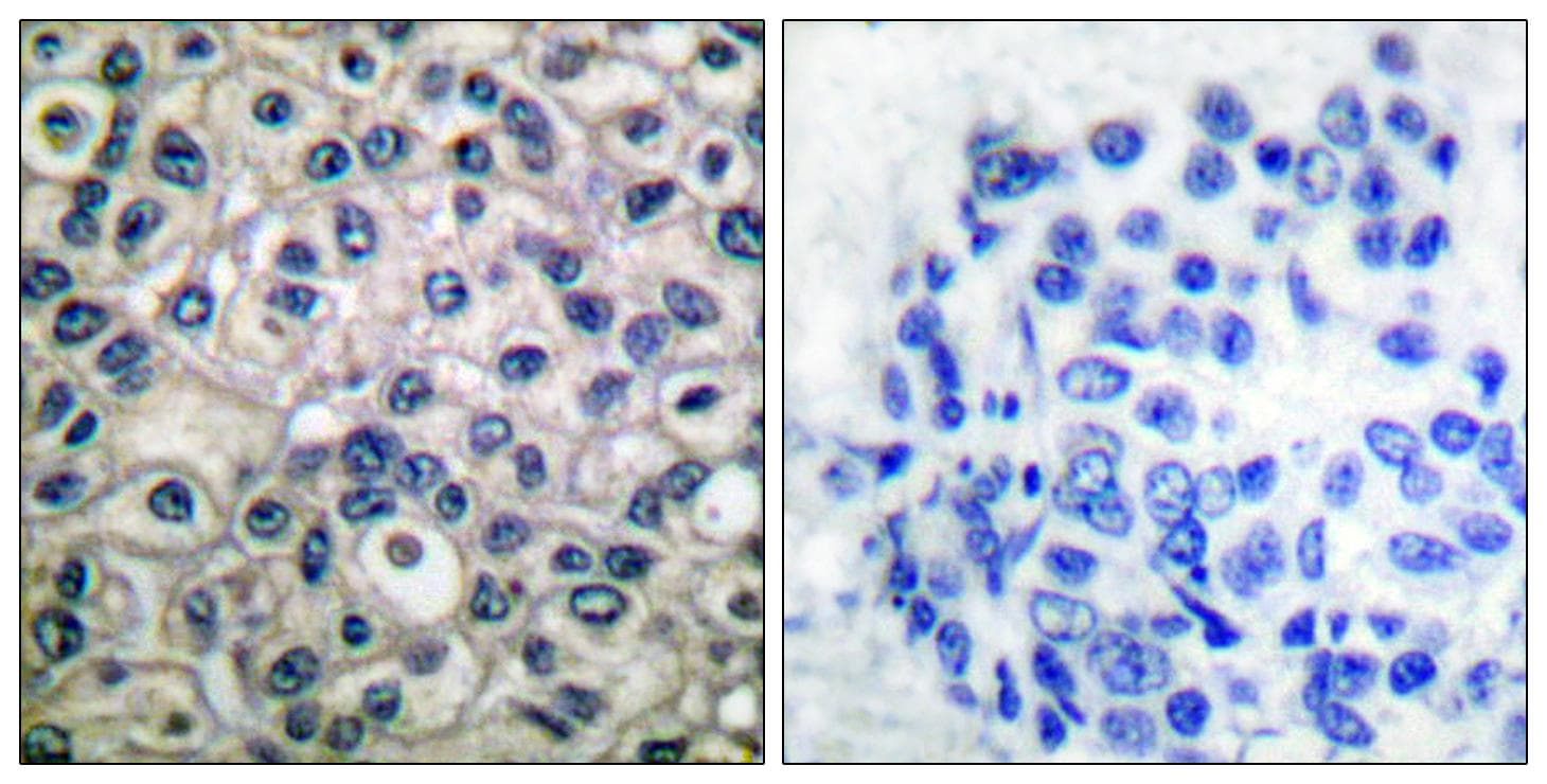 Polyclonal Rabbit anti-Human BCAR1 / p130Cas Antibody (phospho-Tyr410, IHC, WB)