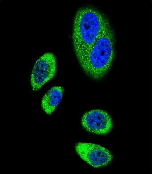 PTGS2 / COX2 / COX-2 Antibody (aa363-391)