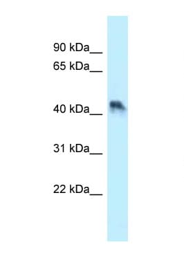 ENTPD5 / CD39L4 Antibody (aa85-134)