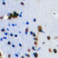 TLE1 / TLE 1 Antibody