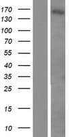 TRPM2 Protein (Over-Expression Lysate Myc-DDK (Flag))
