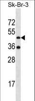 ETNK2 Antibody (aa58-87)