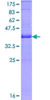 Human ITGAE / CD103 Protein (Recombinant GST, N-terminus)