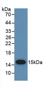 PSCA Antibody (Cy3)
