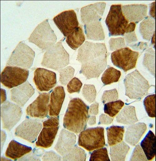 Polyclonal Rabbit anti-Human ZSWIM6 Antibody (aa1148-1177, IHC, WB)