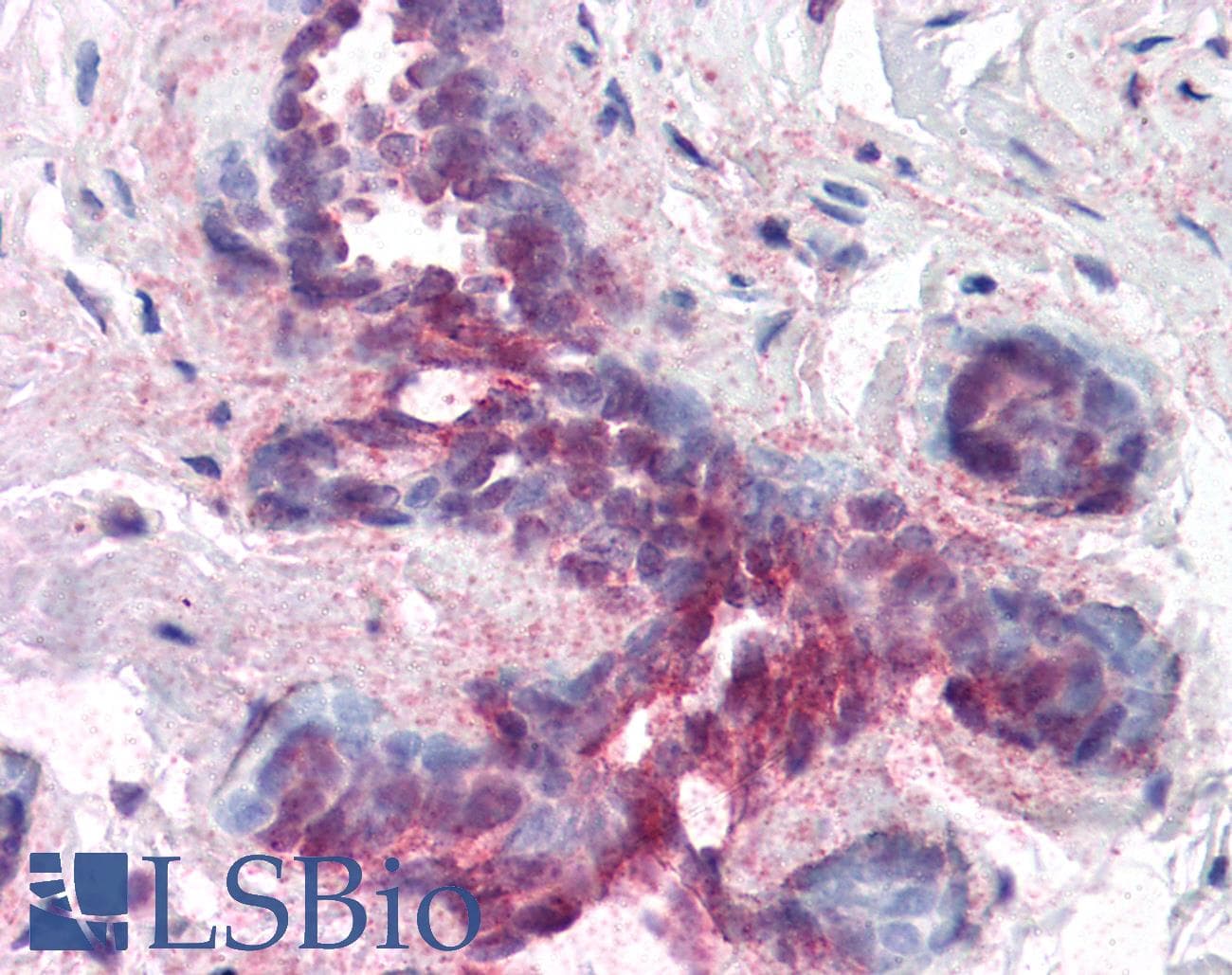 IHC-plus™ Polyclonal Rabbit anti-Human PDCD4 Antibody (phospho-Ser457, IHC, WB)