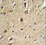 Polyclonal Rabbit anti-Human BGN / Biglycan Antibody (aa148-176, IHC, WB)