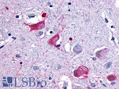 PathPlus™ Polyclonal Rabbit anti-Human MCHR2 Antibody (Cytoplasmic Domain, IHC)