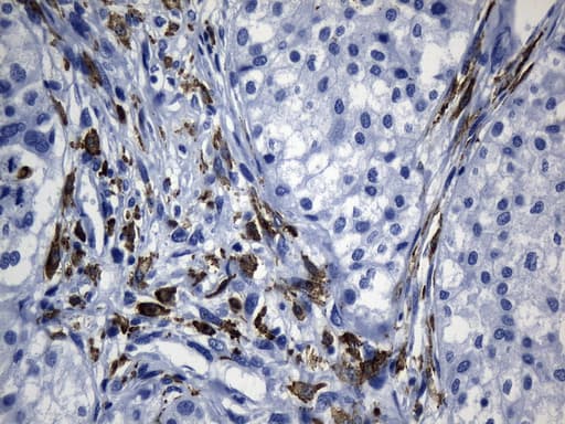Monoclonal Mouse anti-Human MSR1 / CD204 Antibody (clone UMAB247, aa197-451, IHC)