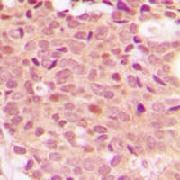 HDAC5 Antibody (phospho-Ser498)