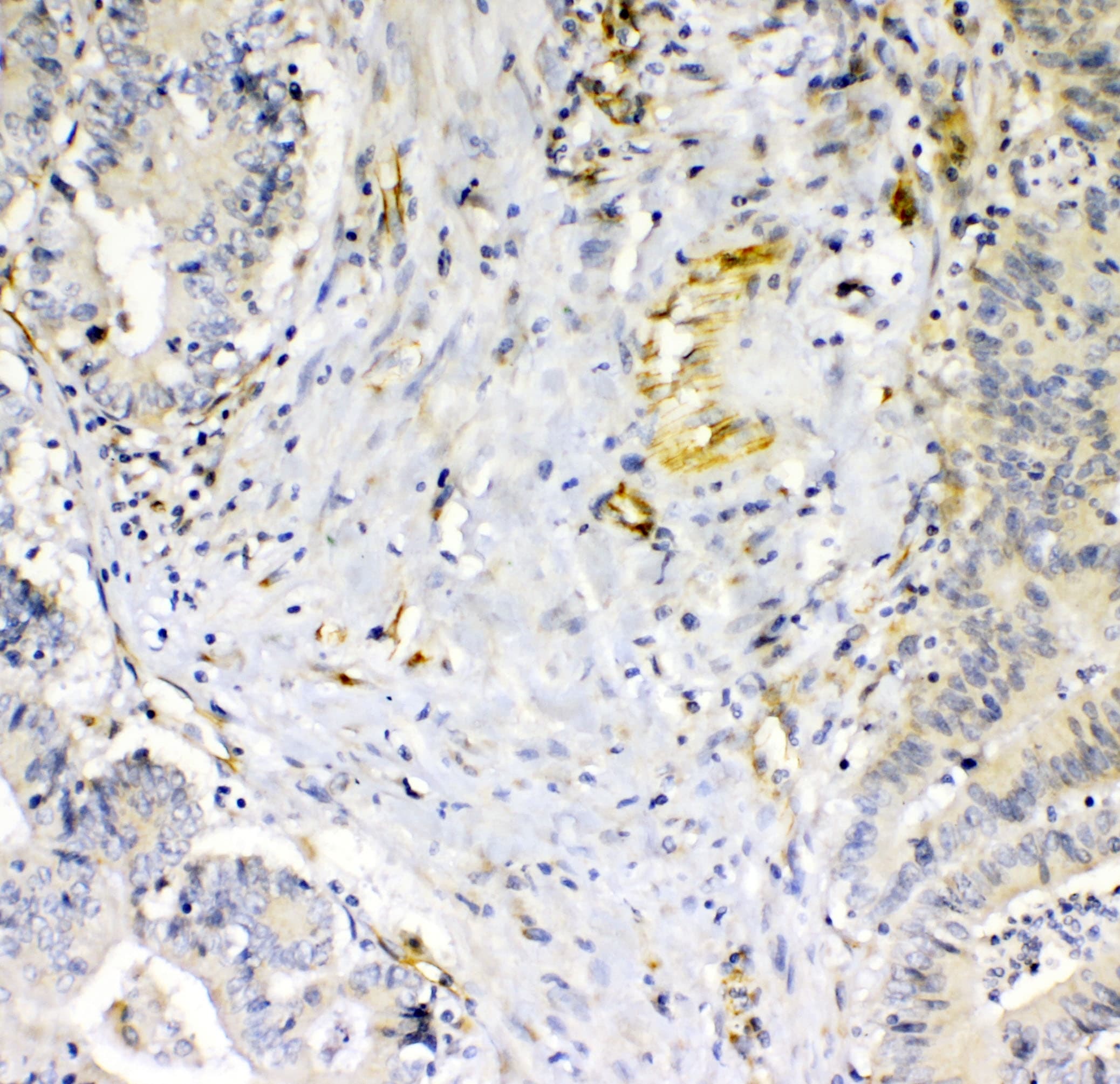 Polyclonal Rabbit anti-Human CD144 / CDH5 / VE Cadherin Antibody (WB)