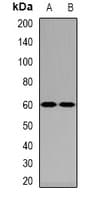 Polyclonal Rabbit anti-Human NPR3 Antibody (WB)