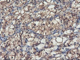 PFKP Antibody (clone OTI2E10)
