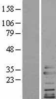 Human CLTA / LCA Protein (Over-Expression Lysate Myc-DDK (Flag))