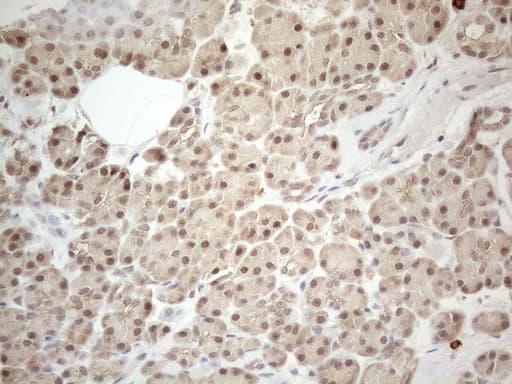 MED15 / ARC105 Antibody (aa393-679, clone OTI2C6)