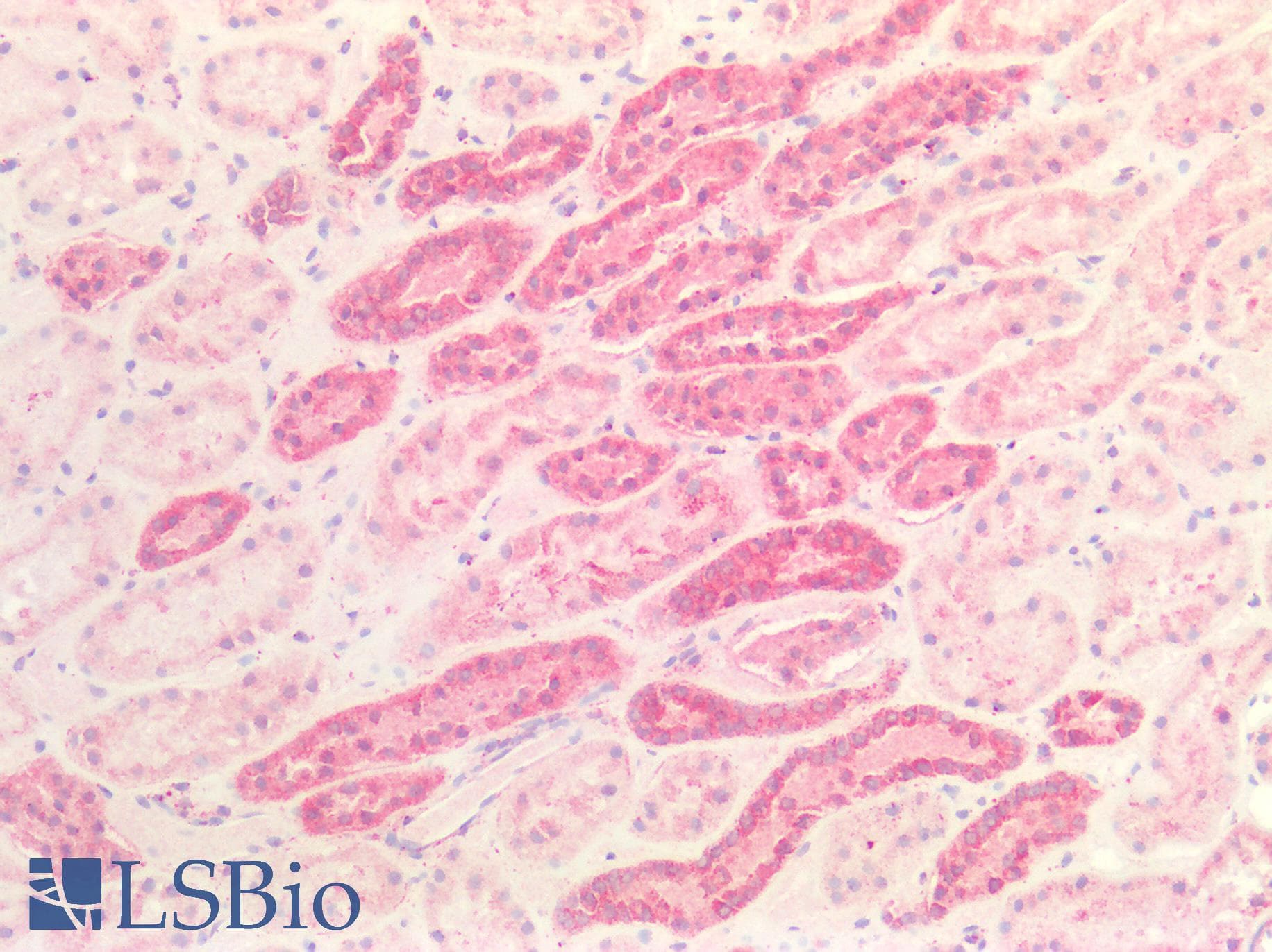 IHC-plus™ RAB5A / RAB5 Antibody (aa182-211)