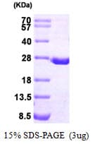 Human DHFR Protein (Recombinant His)