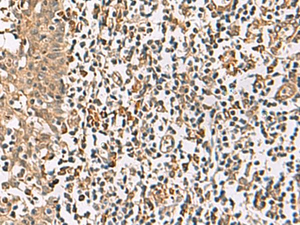 DCAF12 / WDR40A Antibody