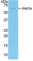 Human CD95 / FAS Protein (Recombinant His-MBP, N-terminus)