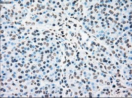 PLK1 / PLK-1 Antibody (clone OTI1A2)