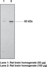 IHC-plus™ CNR1 / CB1 Antibody