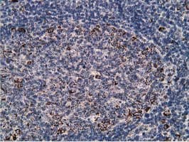 Monoclonal Mouse anti-Human SSX1 Antibody (clone OTI2F8, IHC, IF, WB)